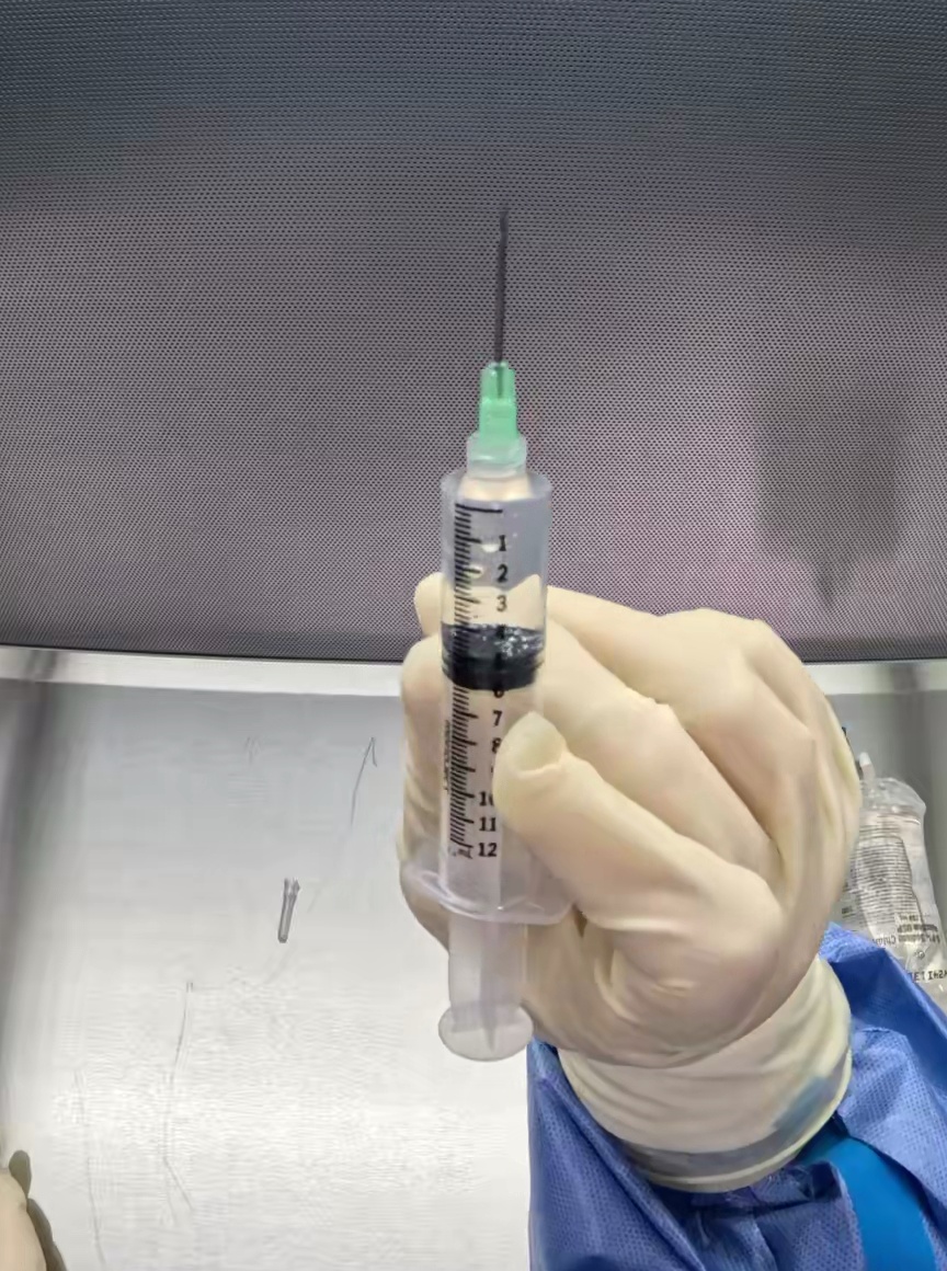 Center Diluent-filled syringe